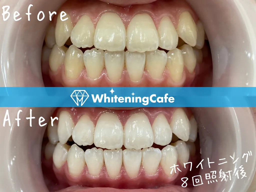 施術前後の様子'1例目'