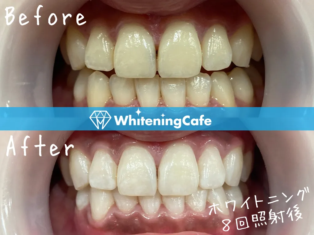 施術前後の様子'5例目'