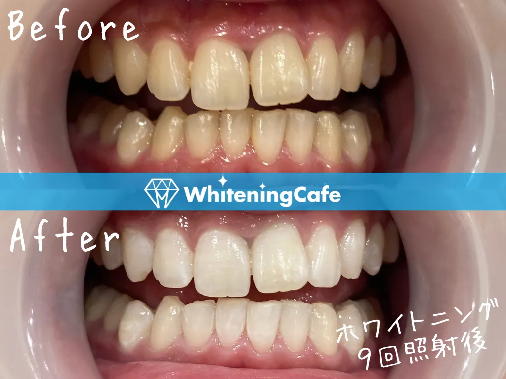 施術前後の様子'6例目'