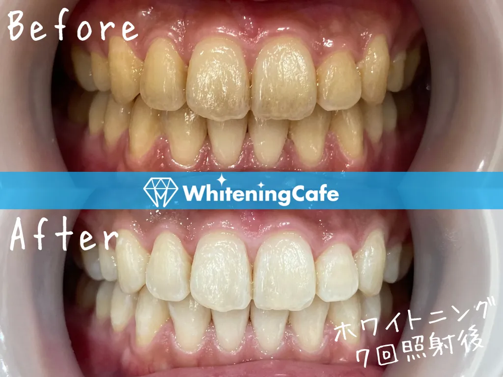 施術前後の様子'7例目'