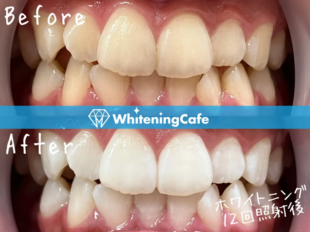 施術前後の様子'9例目'