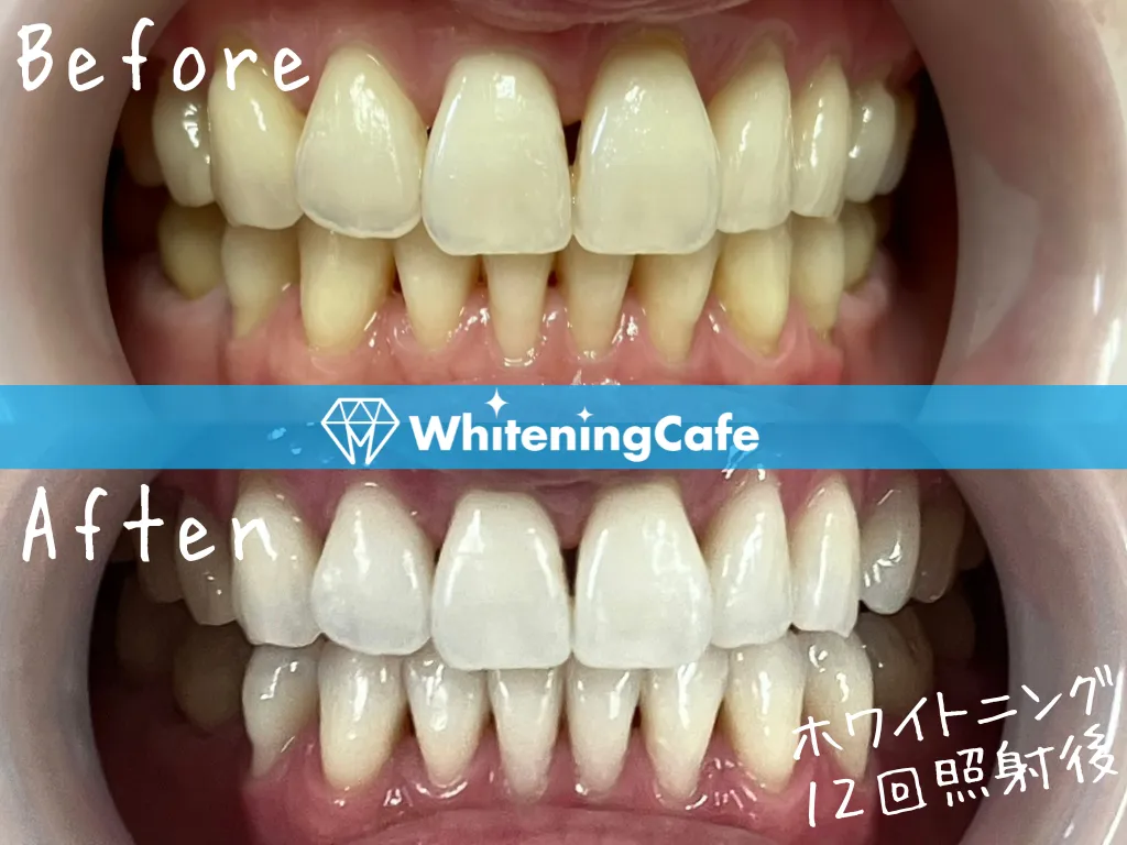 施術前後の様子'11例目'