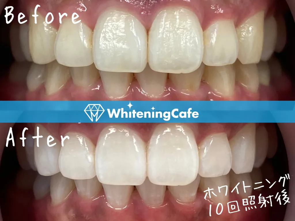 施術前後の様子'12例目'