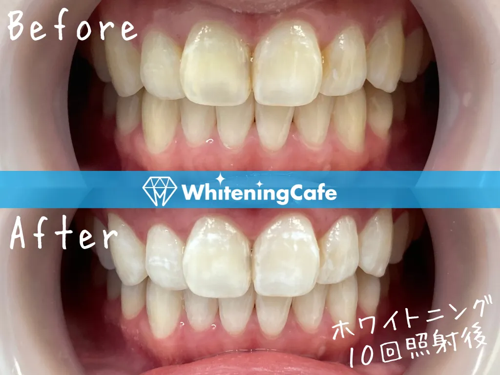 施術前後の様子'14例目'