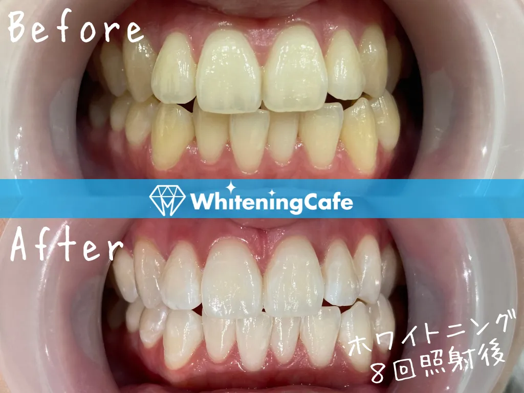 施術前後の様子'16例目'