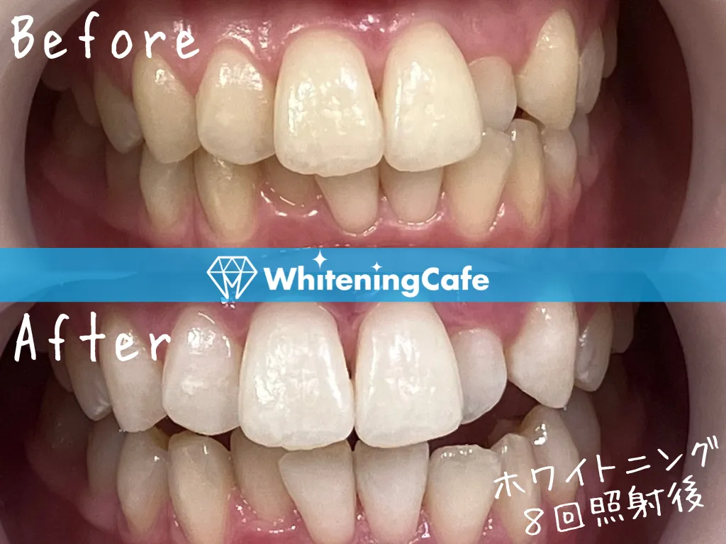 施術前後の様子'18例目'