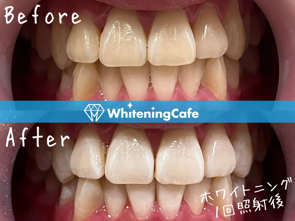 施術前後の様子'19例目'