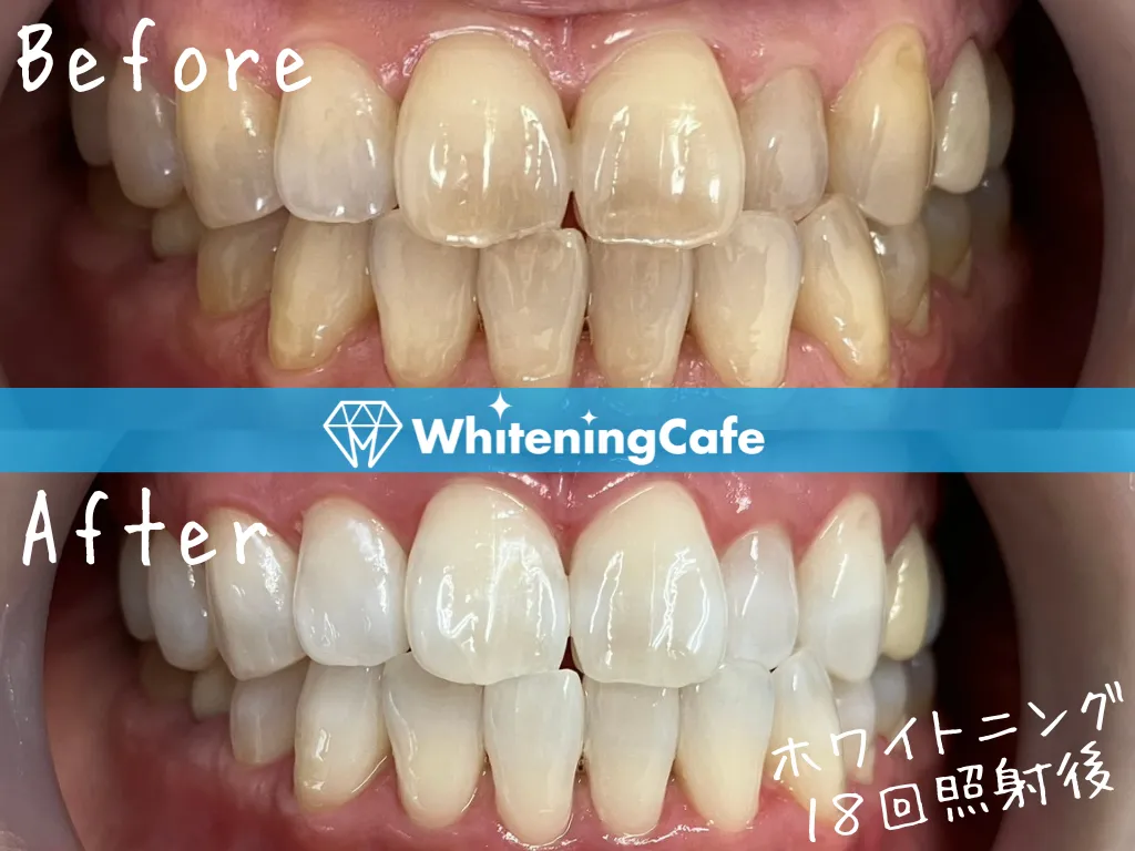 施術前後の様子'22例目'