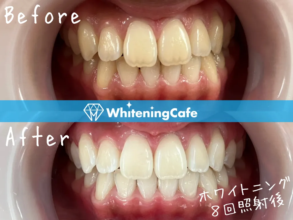 施術前後の様子'24例目'