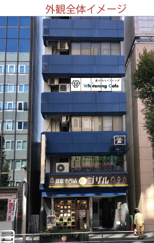 ビルインタイプ
