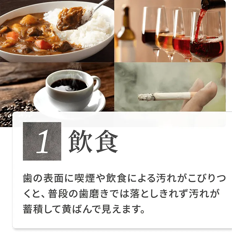 1）飲食 歯の表面に喫煙や飲食による汚れがこびりつくと、普段の歯磨きでは落としきれず汚れが蓄積して黄ばんで見えます。