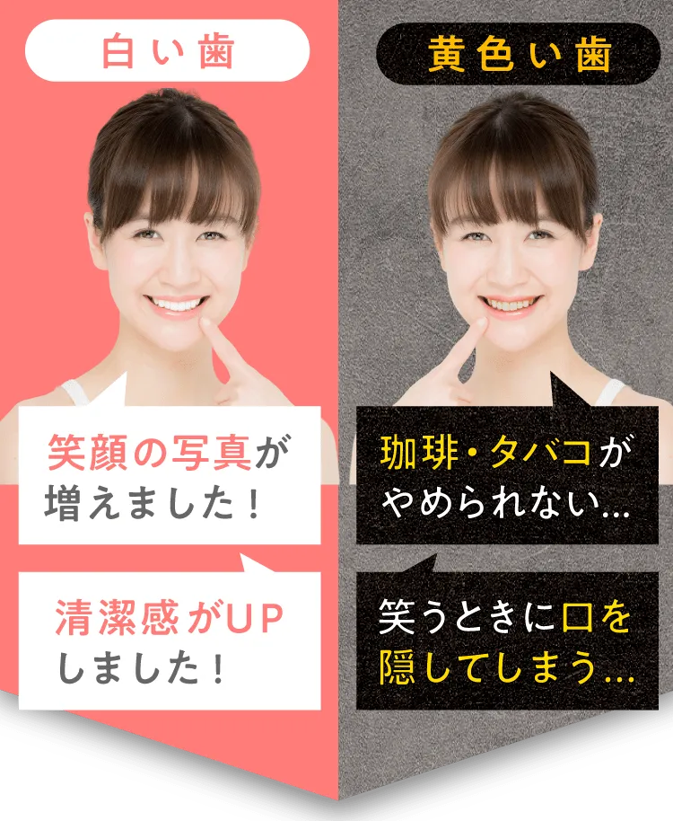 白い歯？黄色い歯？