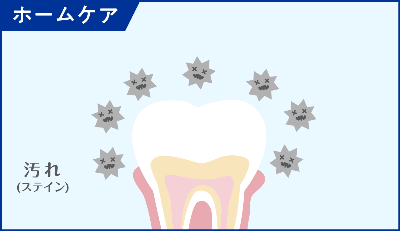 サロンケアのイメージ