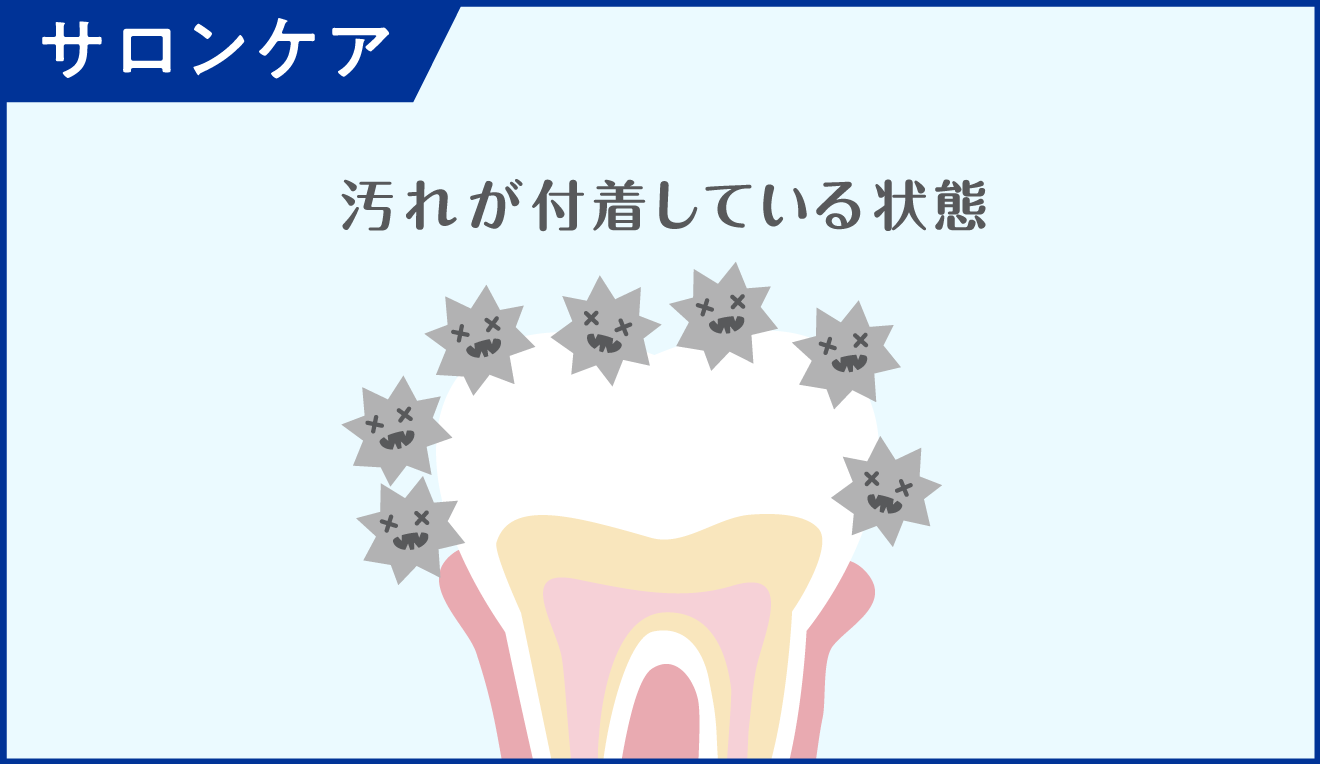 ホームケアのイメージ