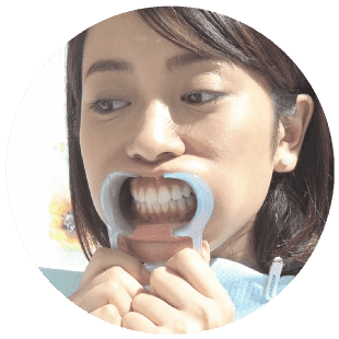 安い 早い 痛くない 歯のホワイトニングwhiteningcafe