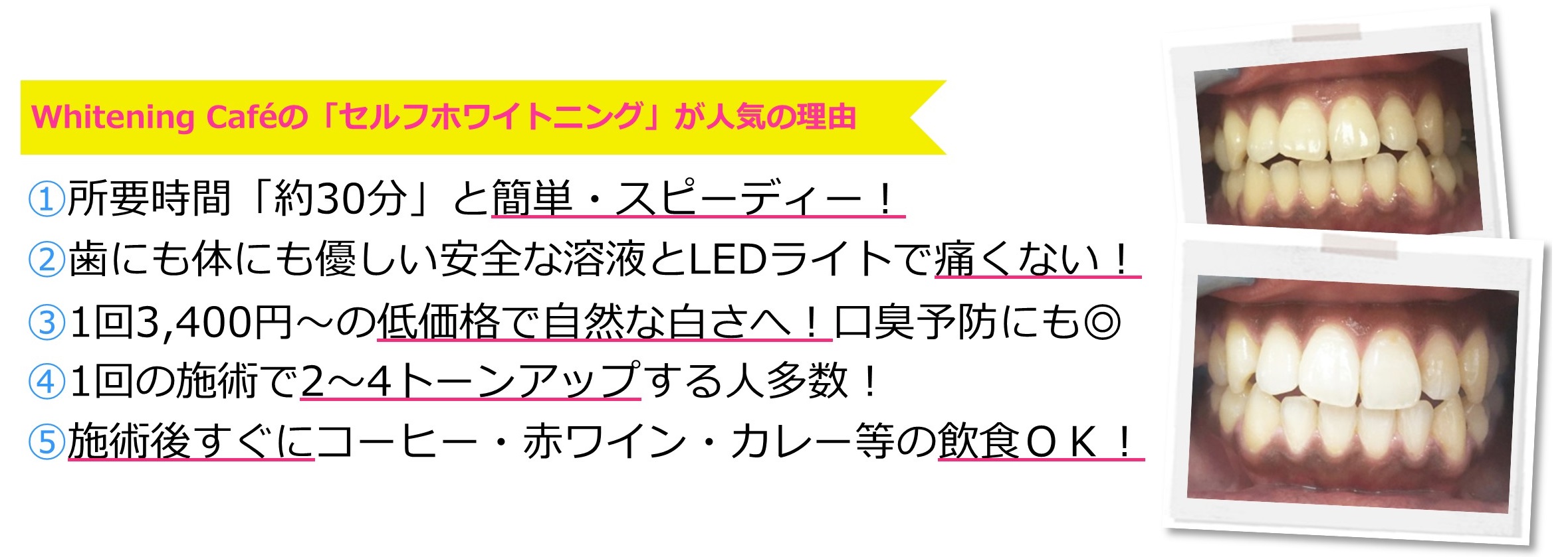 ホワイトニングカフェが人気の理由
