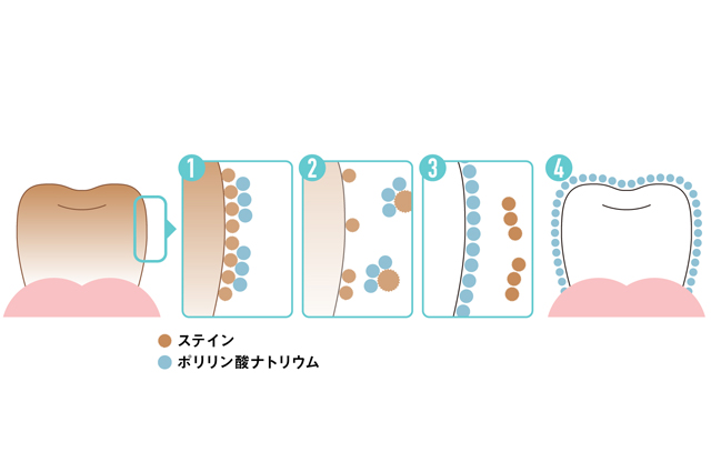 ポリリン酸ホワイトニング