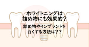 ホワイトニングは詰め物にも効果がある？詰め物も白くする方法は？