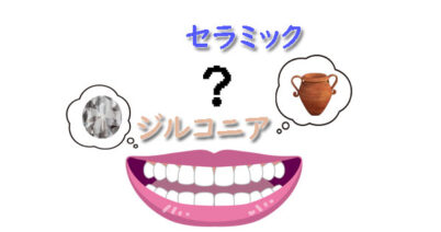 ジルコニアとセラミックの違いとは？それぞれの素材の特徴を徹底比較