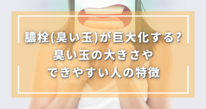 膿栓（臭い玉）は巨大化する？臭い玉の大きさやできやすい人の特徴