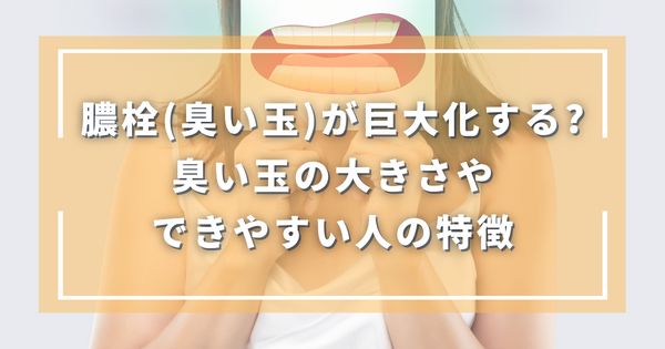 膿栓（臭い玉）は巨大化する？臭い玉の大きさやできやすい人の特徴