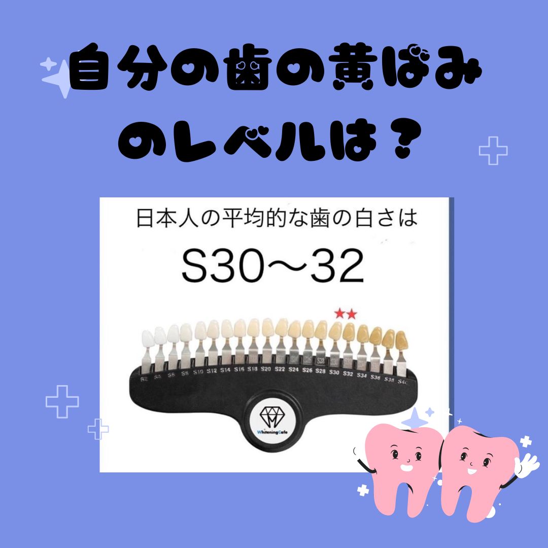 ホワイトニングカフェで白い歯に【WhiteningCafe公式】
