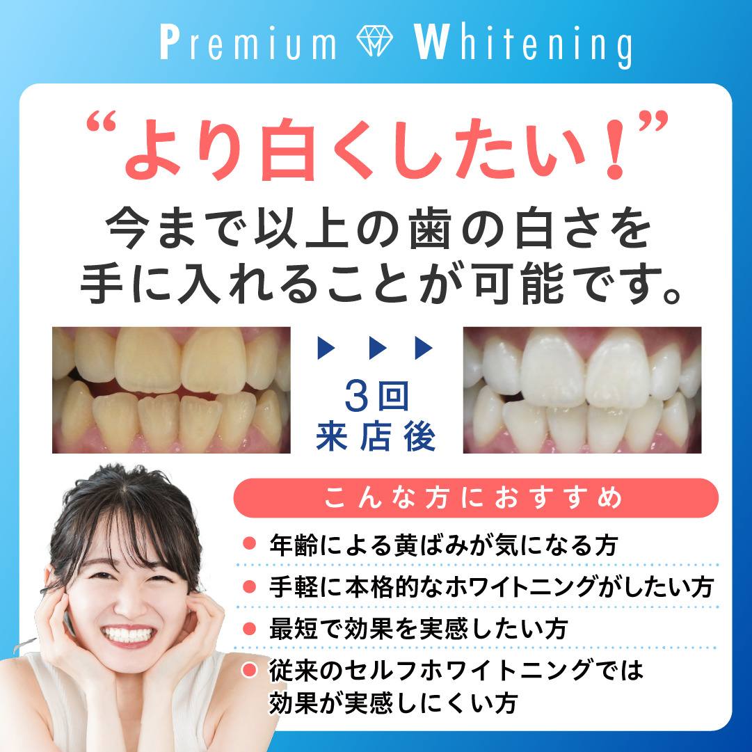 ホワイトニングカフェで白い歯に【WhiteningCafe公式】