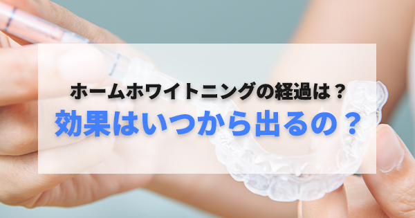 マウスピースにジェルを塗る様子