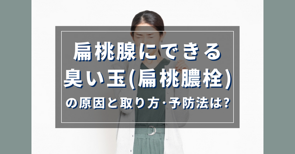 扁桃腺にできる臭い玉（扁桃膿栓）の原因と取り方・予防法は？