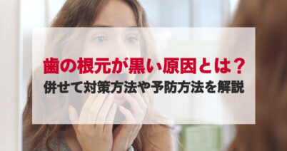 歯の根元が黒い原因とは？併せて対策方法や予防方法を解説