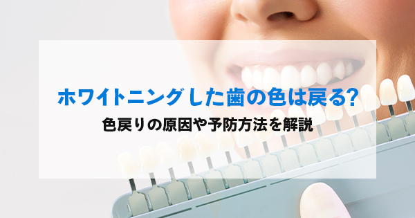 シェードガイドで歯の白さを確認する女性