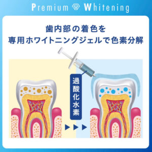 【医療提携】ホワイトニングメニュー導入　単品可 医療提携】ホワイトニングメニュー導入単品可