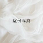 症例写真