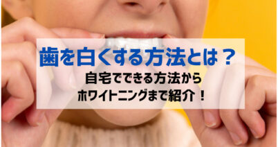 歯を白くする方法とは？自宅でできる方法からホワイトニングまで紹介！