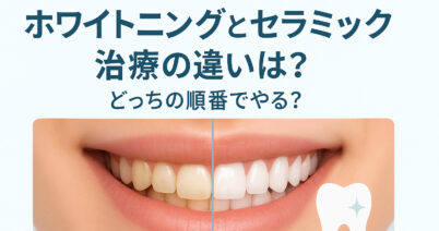 ホワイトニングとセラミック治療の違いとは？白くするためならどっちの順番でやる？