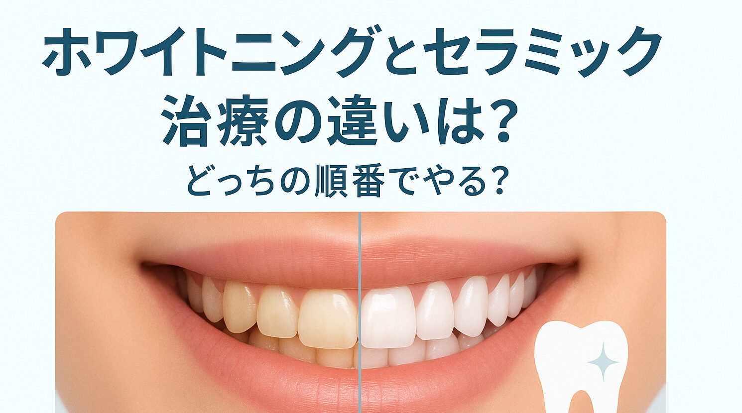 ホワイトニングとセラミック治療の違いとは？白くするためならどっちの