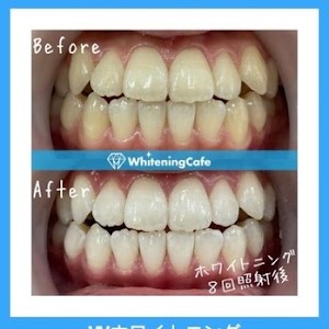 ホワイトニングカフェ和歌山ガーデンパーク店 place picture