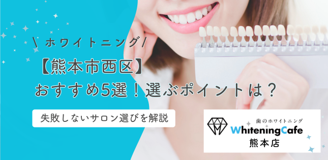 ホワイトニング【熊本市西区】おすすめ5選！安い＆効果が高いのは？