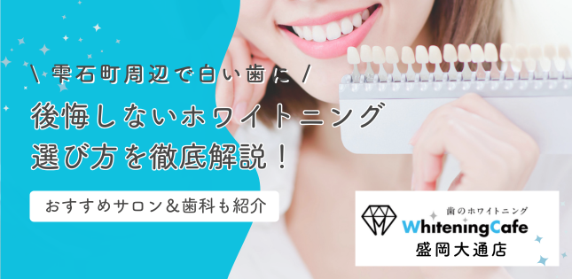 雫石町周辺で白い歯に！後悔しないホワイトニングの選び方を解説