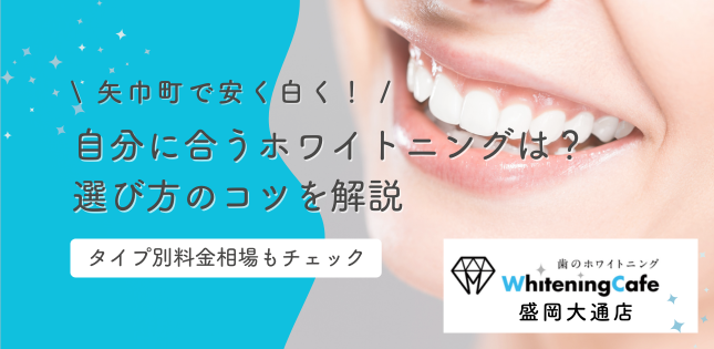 矢巾町で安く白く！自分に合うホワイトニングはどう選ぶ？コツを解説