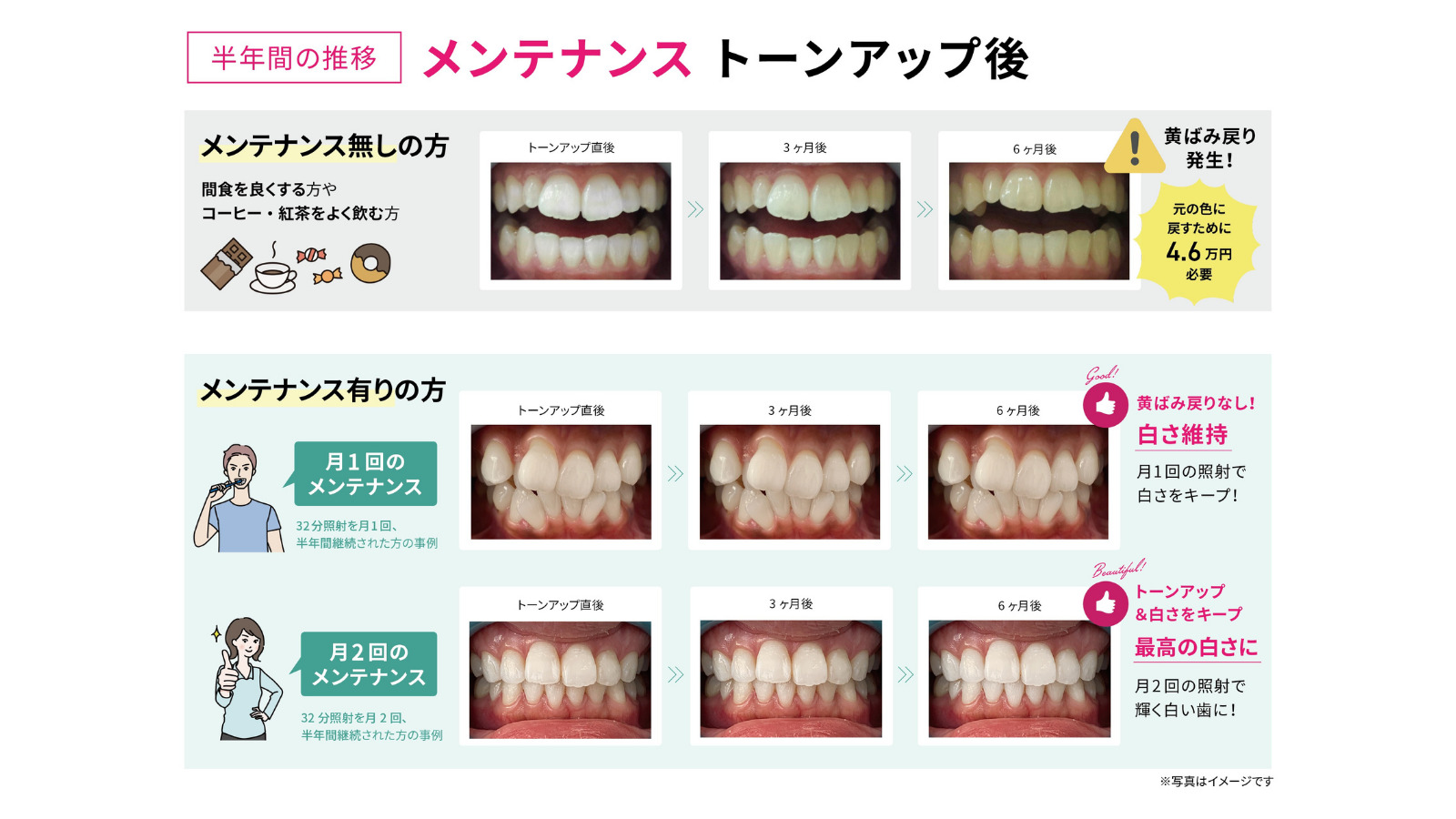 半年間のメンテナンスによる歯の白さ維持効果の比較