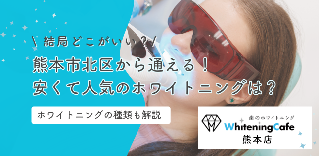 【2026最新】熊本市北区から通える！安くて人気のホワイトニングは？