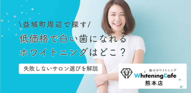 益城町周辺でホワイトニング!低価格で白い歯になれるところは?