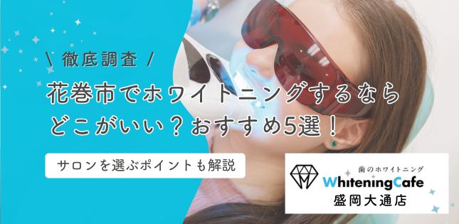 花巻市でホワイトニングするならどこ？選び方のポイントとおすすめ5選