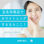 玉名市周辺でホワイトニングできる歯医者・サロンおすすめ5選と料金比較