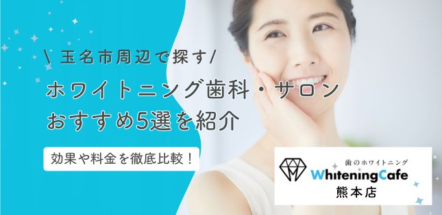 玉名市周辺でホワイトニングできる歯医者・サロンおすすめ5選と料金比較