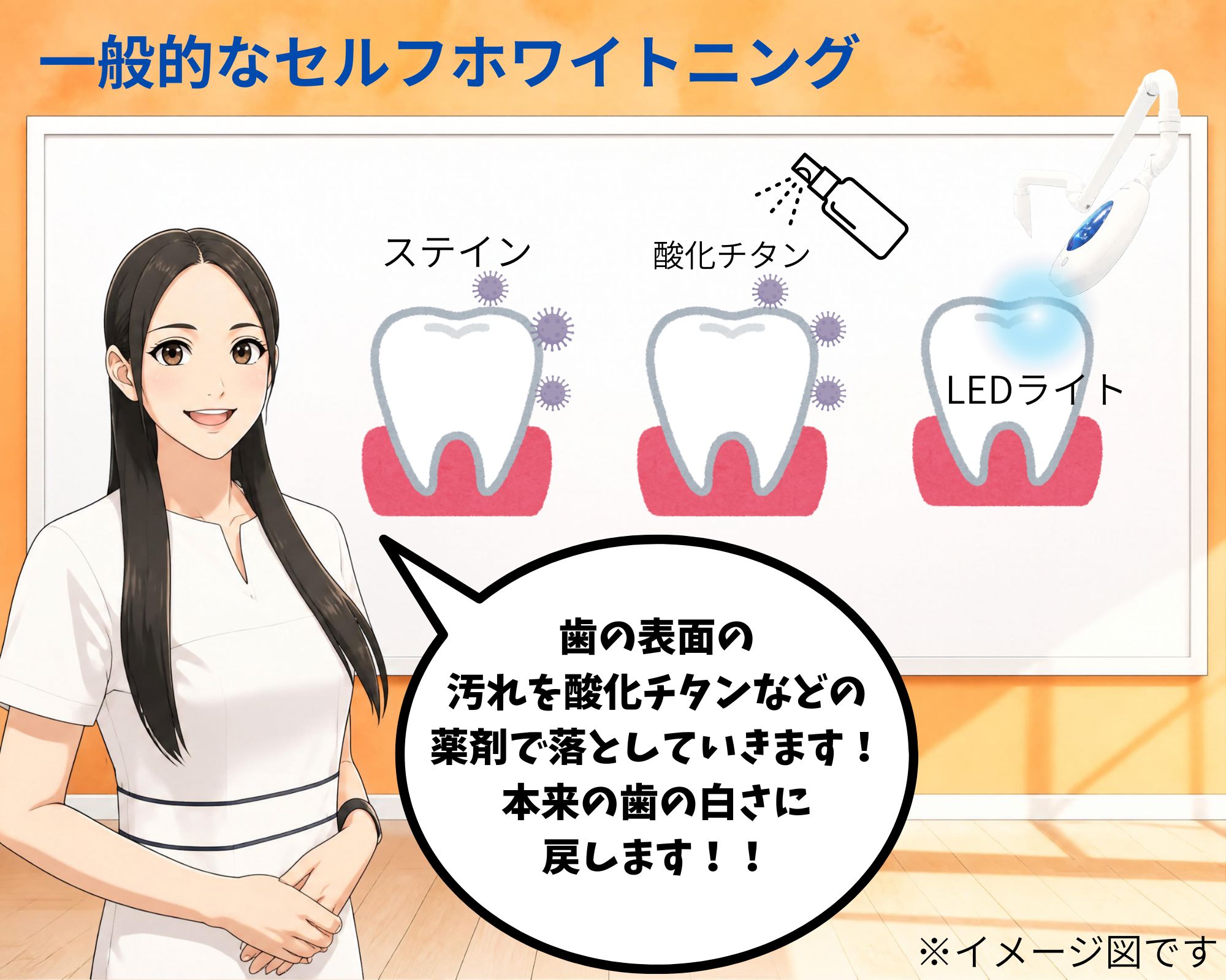 セルフホワイトニングの仕組みを分かりやすく解説した図解イメージ