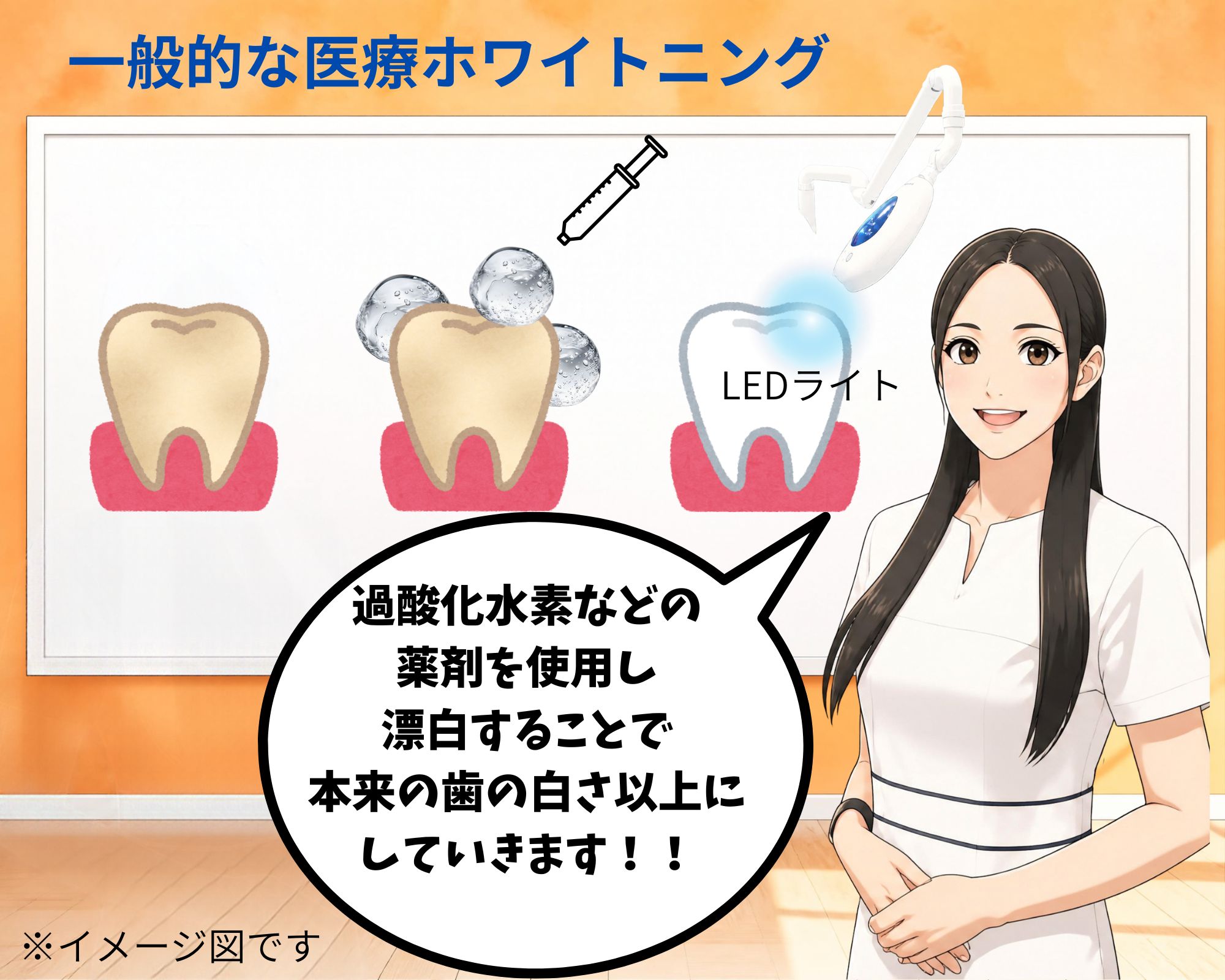 医療ホワイトニングの仕組みを分かりやすく解説した図解イメージ